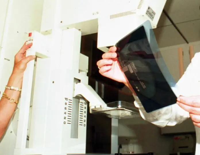 Tumore al seno, i test genomici rafforzano i percorsi di cura