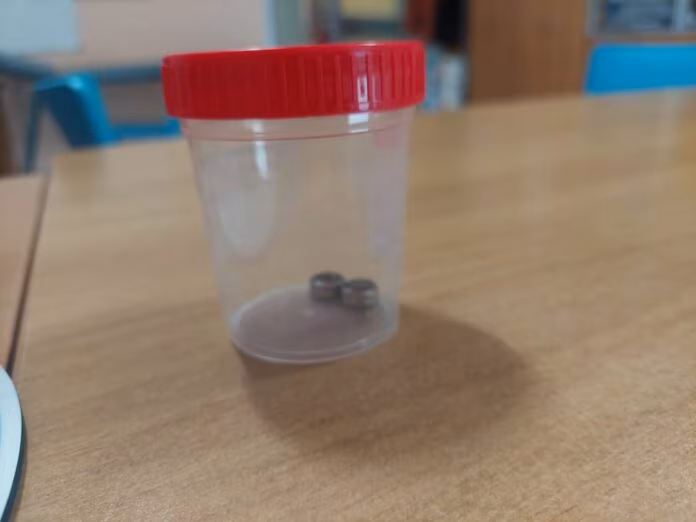 Ingerisce due batterie a bottone, bambina di un anno operata a Catania